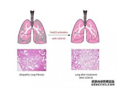 肺纤维化的原因是什么？谁容易发生肺纤维化？