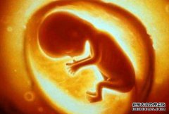 [羊水浊度]羊水浊度如何影响胎儿？