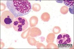 嗜碱性粒细胞增多的原因是什么？