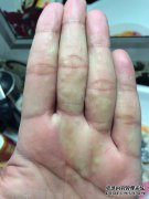 手掌粗糙，粗糙且不柔软。