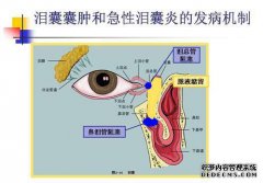 什么是包包？包是怎么到达的？