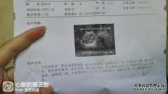 妇女在怀孕7个月时的sd值增加，每周遭受4.4胎子