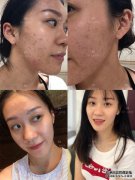 不要使用它，它太令人不被钦佩。