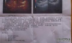 SD和RI对B单曲意味着什么？