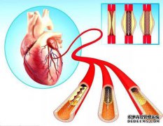 我觉得脚上的血管特别热。谢谢啦