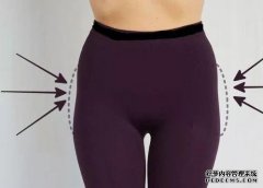 右腰凹陷
