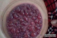 拔罐白虫？拔罐后的正常现象是什么？