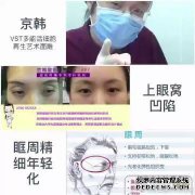 北京仁川专家谈论如何修复多余的面部脂肪填充