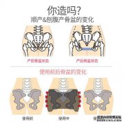 分娩后有一种称为“耻骨分离”的疼痛。五次促