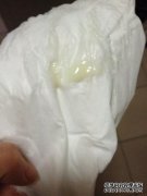 对人给药后四天，有许多类似酸奶的白色带状，