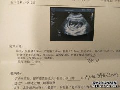 当我去找谭医生时，是的，新台币说这个男孩已