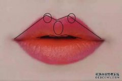 什么是M型整容手术？