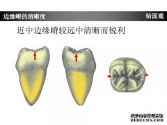 四种通常用于使臼齿向远侧移动的方法的研究进