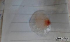 3-4个月咳嗽，白色蟑螂，蟑螂很咸，吃点东西