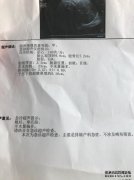 37周的出生测试，首次接触意味着什么？不连接意