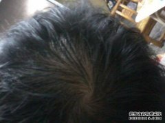 女学生为头发疯狂。头是秃头的，但我无法控制