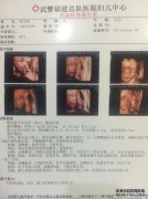 如果Tang风险高，则表示无创且风险低。三维婴儿